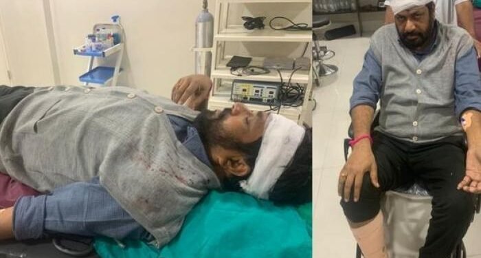 आमदारांच्या अपघाताची मालिकाच सुरु, रस्ता ओलांडताना बच्चू कडूंना अपघात, दुचाकीने दिली धडक