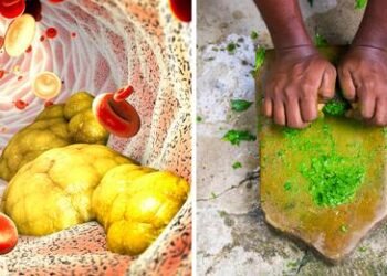 कोलेस्ट्रॉल साचल्याने येतो हार्ट अटॅक,हा हिरवा पदार्थ नसा करतो मुळापासून साफ…