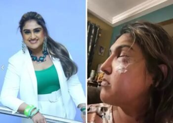 डोळ्यावर जखमा, चेहरा सुजला… अभिनेत्रीवर अज्ञाताकडून भररस्त्यात हल्ला, फोटो शेअर करत दिली माहिती