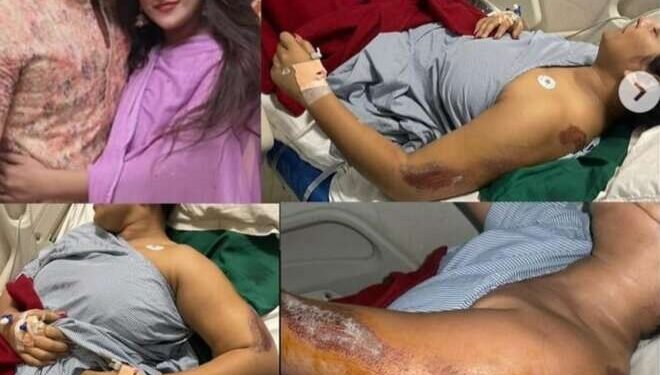 ठाण्यात MSRDCच्या बड्या अधिकाऱ्याच्या मुलाची प्रेयसीला मारहाण, पायावर रेंज रोव्हर चढवली