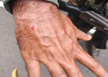 गडचिरोली – धोडराज नजीक आय ई डी स्फोटात दोन जवान जखमी