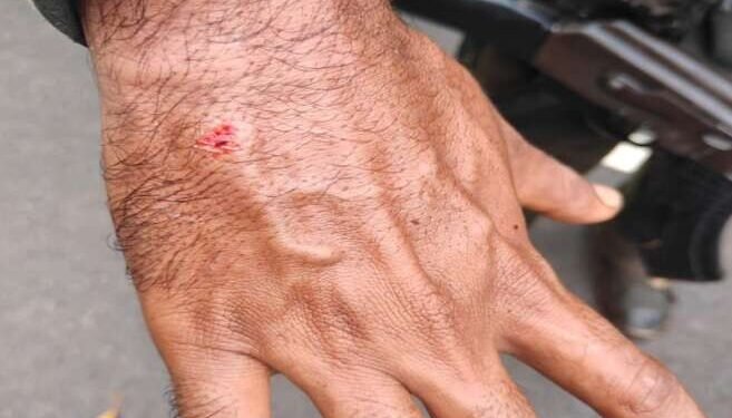 गडचिरोली – धोडराज नजीक आय ई डी स्फोटात दोन जवान जखमी